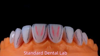 Standard Dental Lab Co., Limited 제조업체의 생산 라인