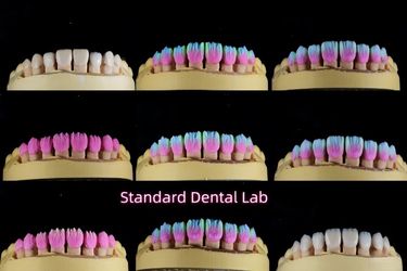 Standard Dental Lab Co., Limited 제조업체의 생산 라인