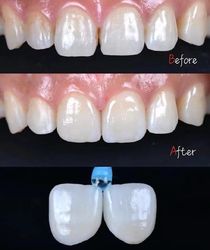 Standard Dental Lab Co., Limited 제조업체의 생산 라인