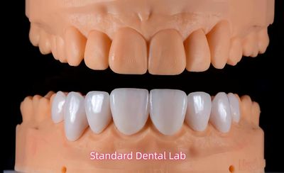 Standard Dental Lab Co., Limited 제조업체의 생산 라인