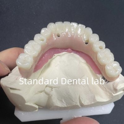 주문 미적 복원 4개의 치아 임플란트 모두 Zirconia Hypo Allergenic 온라인 제품