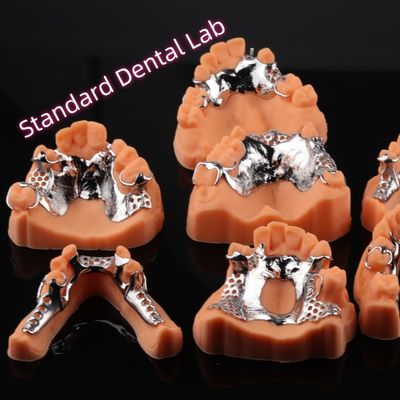 주문 CAD CAM 제거 가능한 부분 치아 금속 프레임 3Shape Exocad 치아 디자인 온라인 제품
