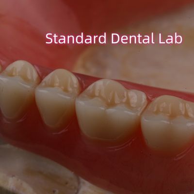 주문 SDL 열 절제 아크릴 부분 치아 이보클러 치아 치아 연구소 높은 정확성 온라인 제품