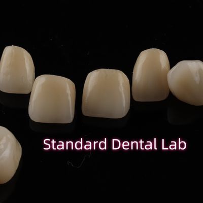 주문 치과 강층 Zirconia 왕관 전체 상부 아크 복원 온라인 제품