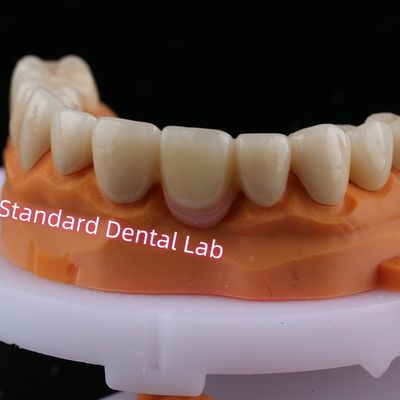 주문 디지털 CAD CAM 프레싱 장층 지르코니아 브리지 크라운 온라인 제품