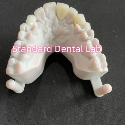 주문 스타의 미소 치아 에맥스 지르코니아 라미네이트 폼리 0.6mm 온라인 제품