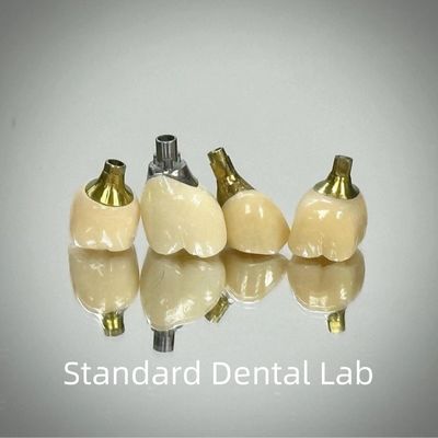 주문 전문적인 지르코니아 나사 장착 임플란트 크라운 티타늄 CAD CAM 온라인 제품
