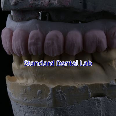 주문 포르셀라인 4면 다리 지르코니아 다리 높은 미용 치아 임플란트 다리 온라인 제품
