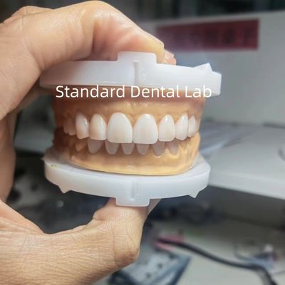 주문 완벽한 미용 China Dental Lab의 치아 수분을 사용하는 치과 전문가를 위한 임시 수액 온라인 제품