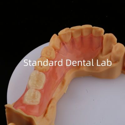주문 에이스 치아 핑크/다크 TCS 밸플라스트 유연한 치아 치아 3D 프린트 모델 온라인 제품