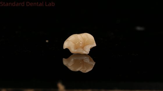 주문 강성 엠맥스 세라믹 크라운 치아 론레이 우수한 얼룩 저항성 중국 치과 연구소 온라인 제품
