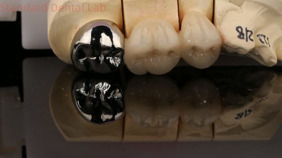 주문 비타 포스텔리언 풀 메탈 크라운 포스트 코어 3년 보증 온라인 제품