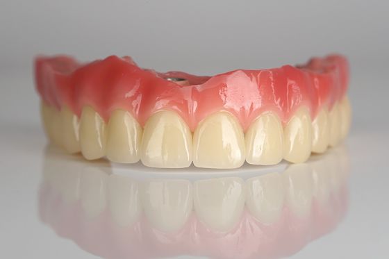 주문 풀 아치 지르코니아 임플란트 브릿지 4개 / 6개 모두 치아 임플란트 빠른 회복 온라인 제품