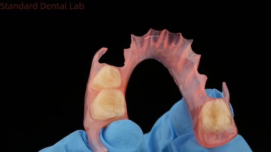 주문 3D 프린트 모델 치과 TCS 밸플래스트 유연 부분 치과 분홍색 / 어두운 색 치과 실험실 제품 온라인 제품
