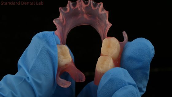 주문 치과 TCS 밸플래스트 유연한 부분 치과 네스비트 밸플래스트 마무리 중국 치과 연구소 밸플래스트 클래시프 온라인 제품