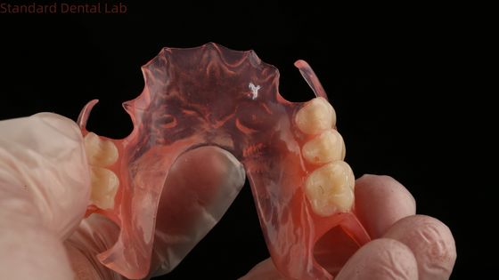 주문 에이스 치아 핑크/다크 TCS 밸플라스트 유연한 치아 치아 3D 프린트 모델 온라인 제품