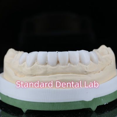 진단 복원 치과 밸시 업 포니어 높은 미용