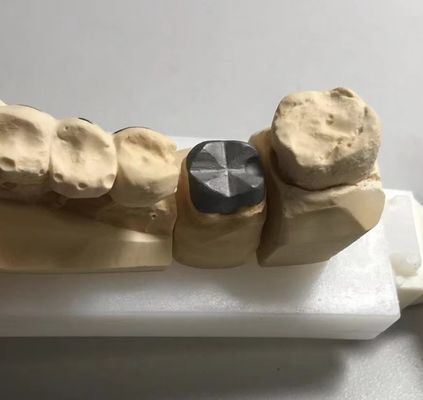 ISO FDA CE 치과 금속 기둥 및 코어 크라운 PFM 잘 맞습니다