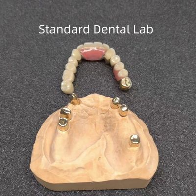CAD CAM 치아 부분 치아 부착 치과 전문 정확