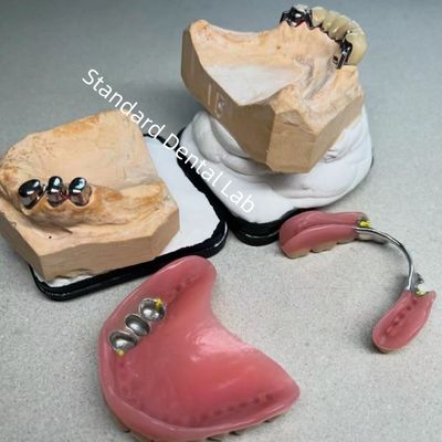 높은 미학 CAD CAM 치아 부분 치아 부착 교체 표준 치과 연구실