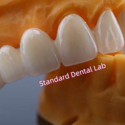 CAD CAM 밀 Zirconia Crown Bridge 고도로 생물 호환성
