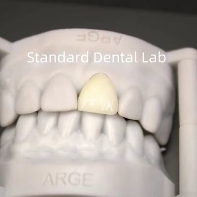디지털 CAD CAM 치과 연구실 왕관 투명층 지르코니아 왕관