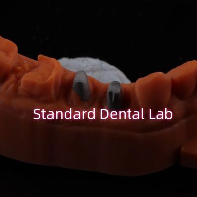 금속 포스트 코어 크라운 CAD CAM 포르셀라인 / 지르코니아 코핑 풀 지르코니아 브루시어 크라운
