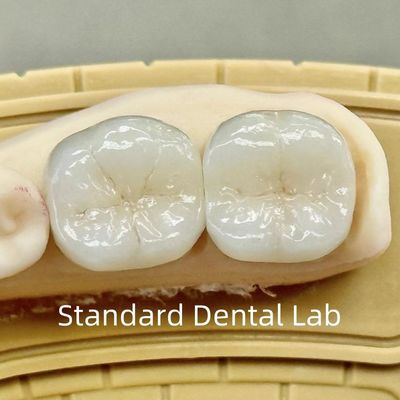 치과 실험실 왕관 반투명한 전체 윤곽 Zirconia 뛰어난 강도