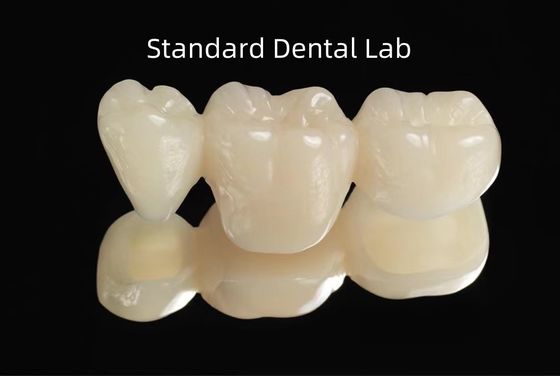 CAD CAM 빈 PMMA 임시 치과 임시 다리