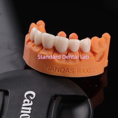 디지털 CAD CAM 치과 연구실과 함께 편안함과 기능 투명층 지르코니아 다리