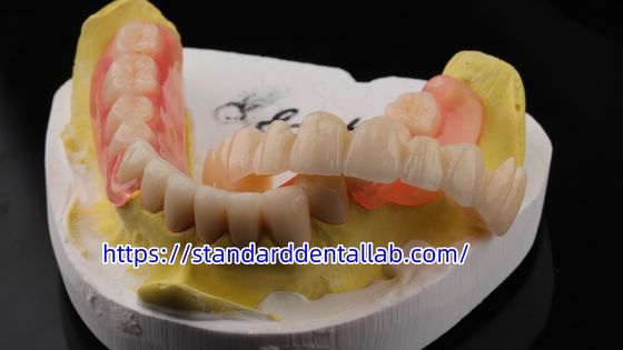 높은 미용 치과 TCS Valplast 유연 부분 치아 치과 연구실 Valplast 클래프 분홍 색조