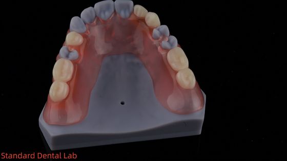 3D 프린트 모델 높은 미학 치과 TCS 밸플라스트 유연 부분 치과 치과 연구실
