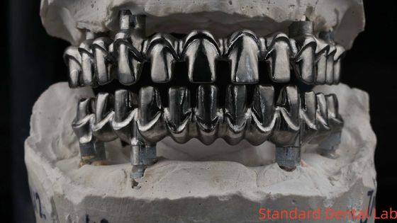 치과 하이브리드 말로 임플란트 브릿지 프로페셔널