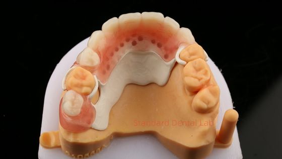 픽 부분 프레임 디자인 ISO CE 및 FDA 치과 연구실 아크릴 부분 치아 프레임