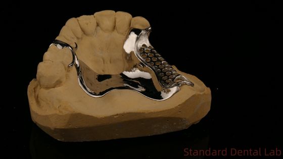 고강도 3D 프린트 된 주사체 프레임 COCR 부분 치아 크롬 코발트 주사 금속 프레임