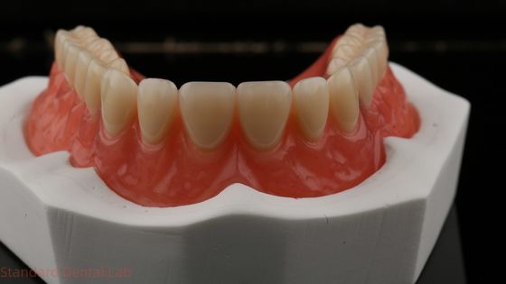Dentsply Lucitone 199 아크릴 치아