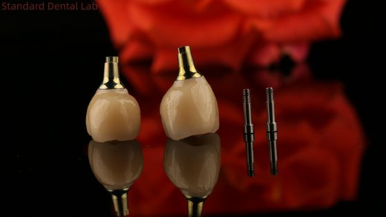 포르셀라인 지르코니아 시멘트 유지 스크루 임플란트 맞춤 맞춤형 미용을 위해 육각형 머리 모양