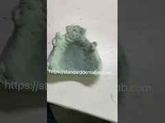 치과 전문 인을위한 빠른 및 주조 프레임 코-Cr 금속 부분 치아 프레임