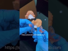 FDA 코발트 크롬 높은 미적 명확한 프레임 부분