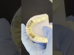 금속 주조 포스트 코어 크라운 코크 정밀 유지 풀 지르코니아 브루시어