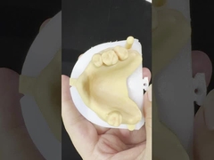 금속 합금 부분 코발트 크롬 치아 Ivoclar Scheftner 편안한 금속 프레임