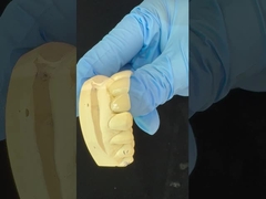 전체 컨투르 지르코니아 왕관/고도 미적 자연 맞춤형 에이디트 지르코니아 치아 다리