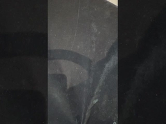 티타늄 임플란트 지원 치아 치아 임플란트 이상 정밀 이보클라 치아