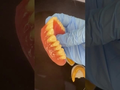 전체 상단 및 하단 스티플라트 아크릴 부분 치아 이보클라 치아 분홍  gomme